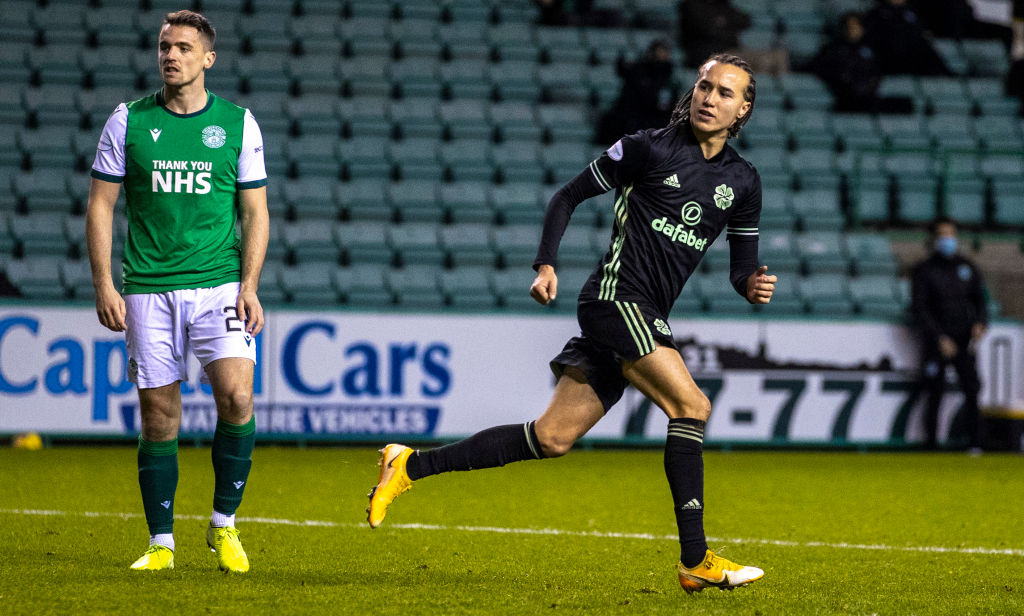 Hibernian v Celtic - Ladbrokes Scottish Premiership