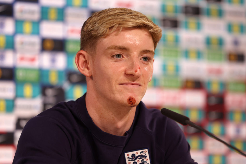 England Training Session & Media Activity - UEFA EURO 2024